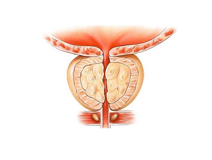 vnetje prostate